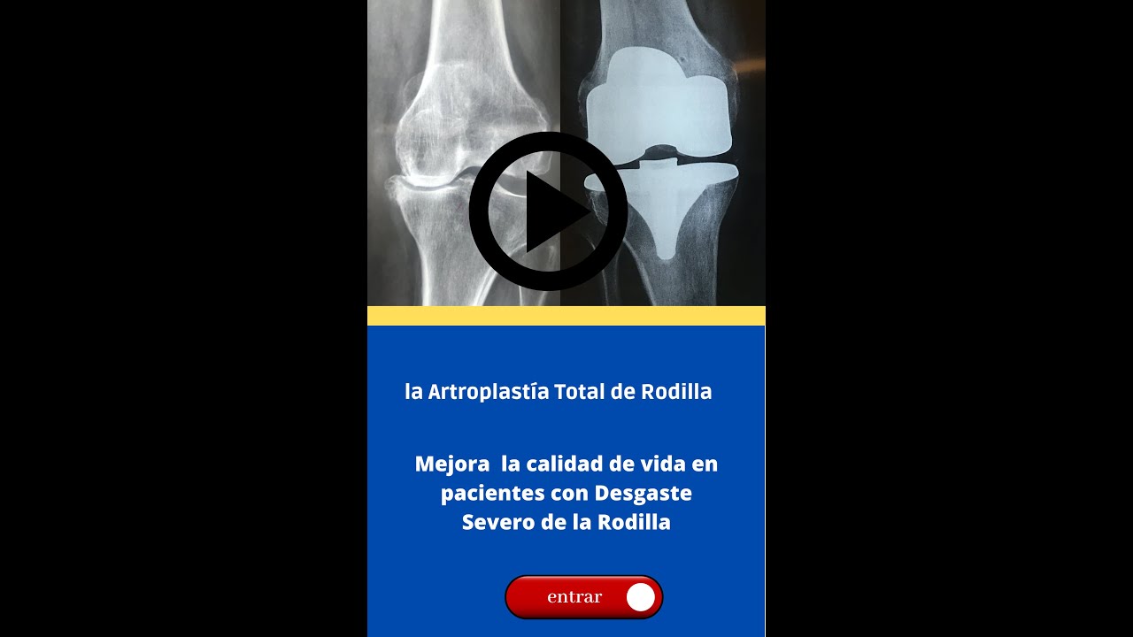 Rey Armando Cárdenas Acuña-14