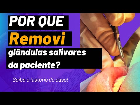 Francisco De Assis Almeida Lima Júnior-128