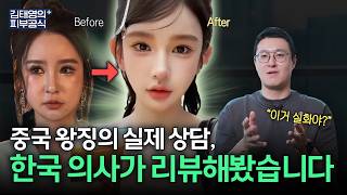 코필러 vs 코성형 하기 전에 이 영상 꼭 보세요!(feat. 코필러 시술 전 후)-피부과 전문의 닥터피부광
