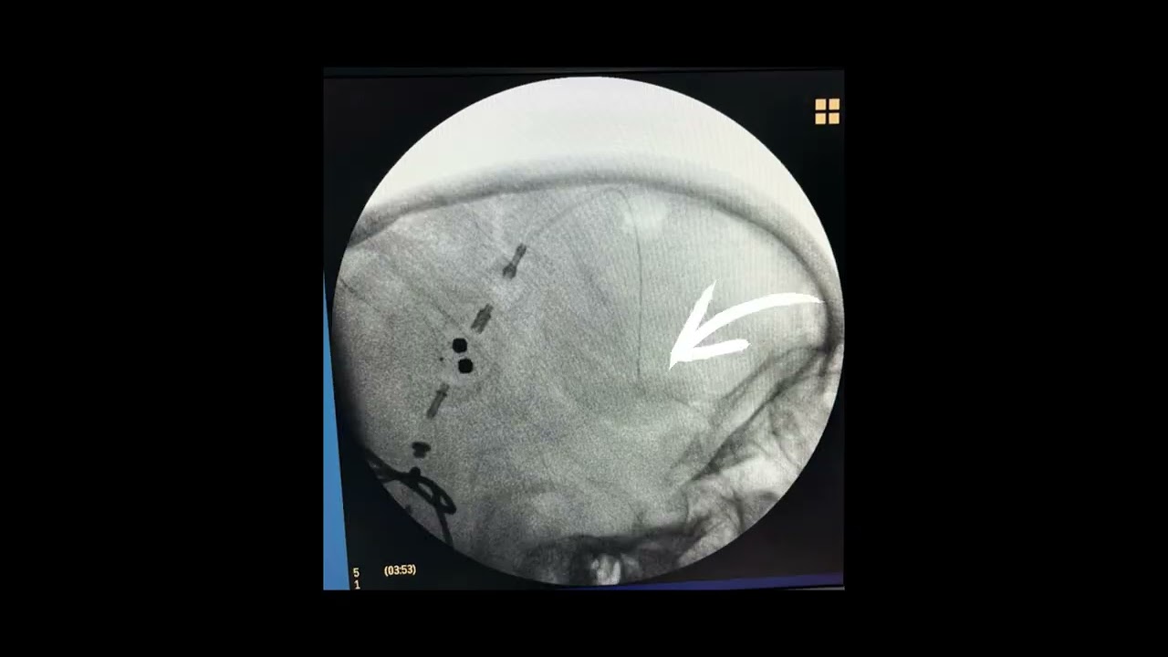 Gerson Reyes Rodríguez-84