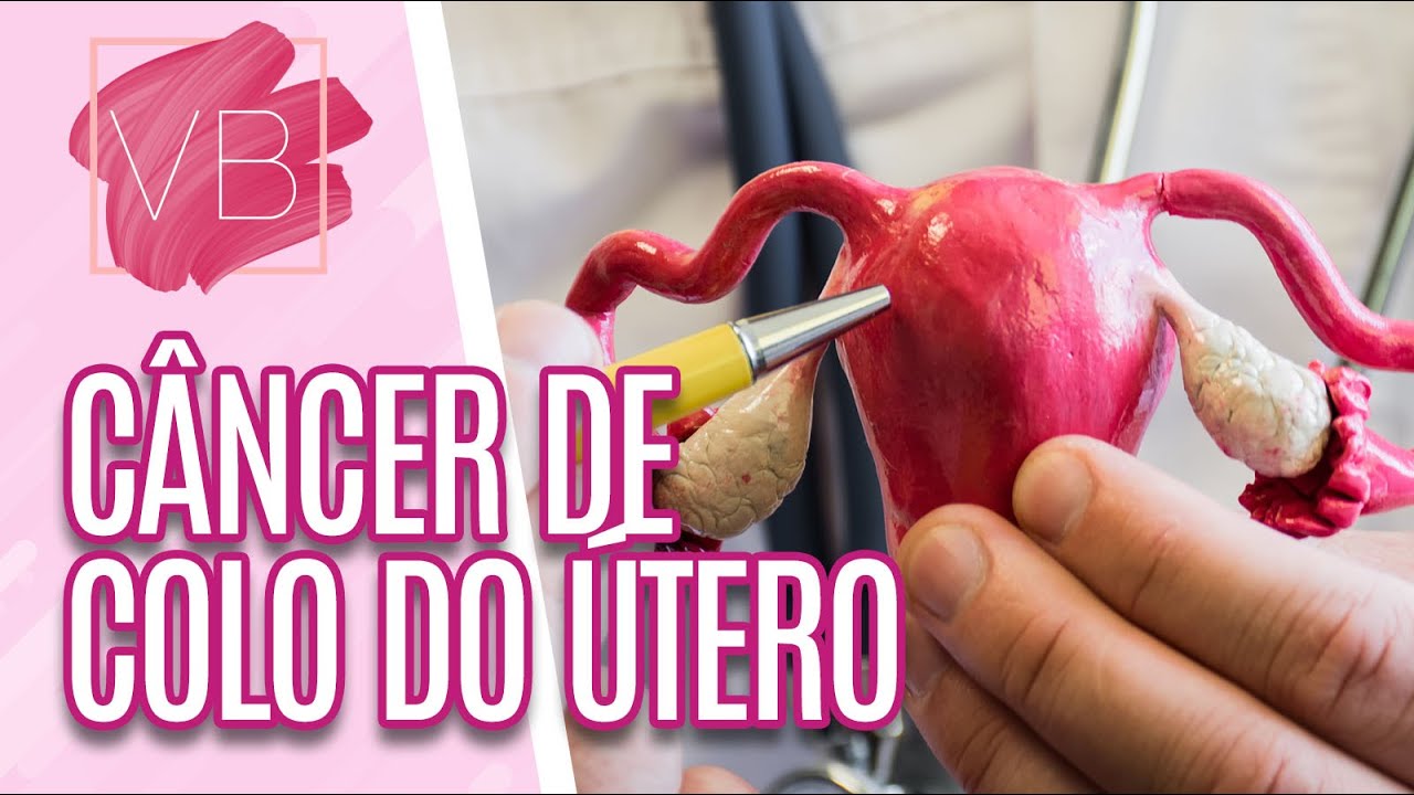 Entenda mais sobre câncer de colo do útero - Você Bonita (08/12/20)