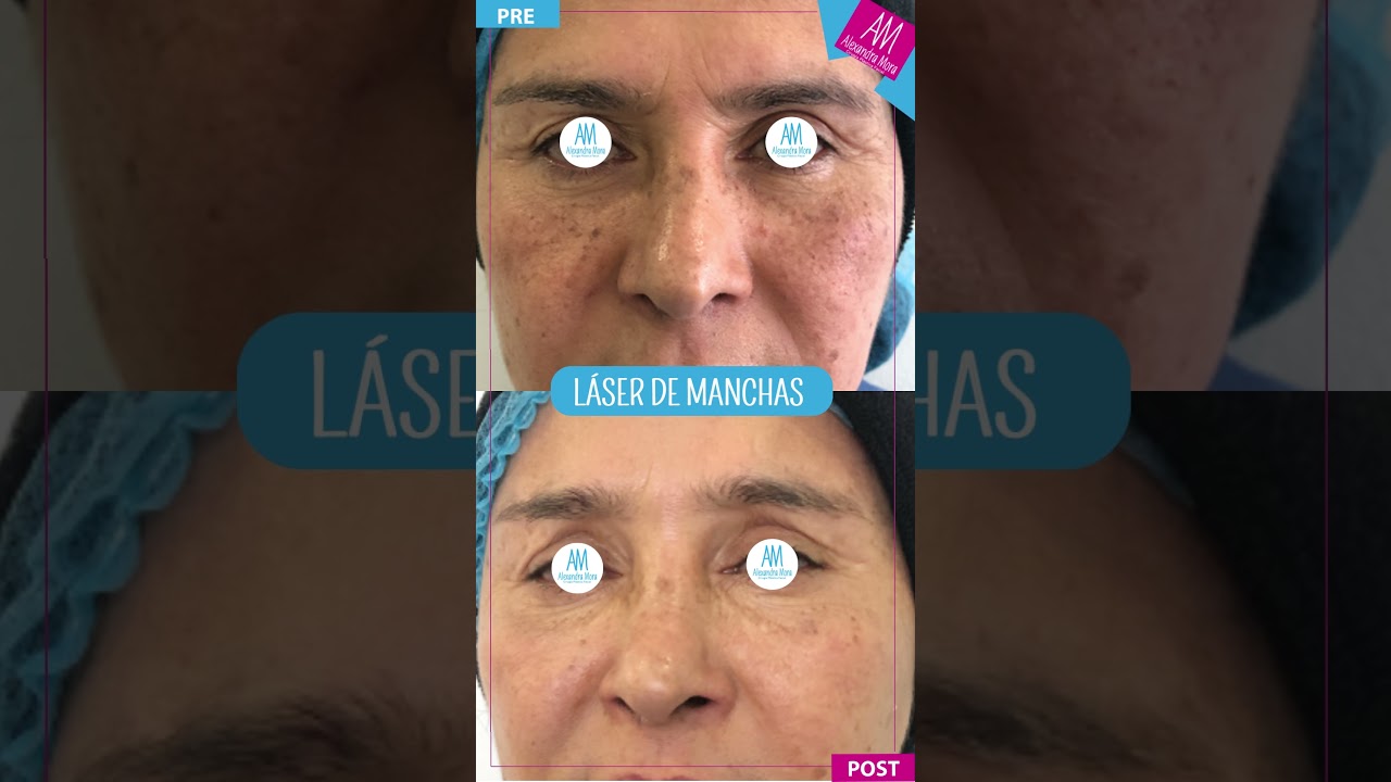 Alexandra Mora Hernandez-107