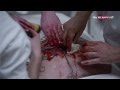 the knick trailer 
