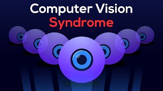 How I CURED my EYE STRAIN (Relief from Computer Vision Syndrome )