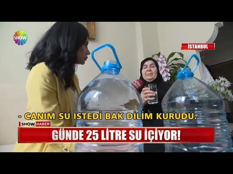 Günde 25 litre su içiyor!