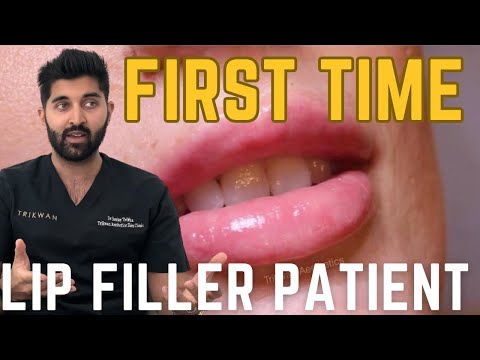 First Time Getting Lip Fillers | What Should I Expect