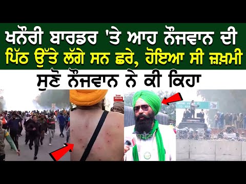 Khanuri Border LIVE | ਆਹ ਨੌਜਵਾਨ ਦੀ ਪਿੱਠ ਉੱਤੇ ਲੱਗੇ ਸਨ ਛਰੇ, ਹੋਇਆ ਸੀ ਜ਼ਖ਼ਮੀ, ਸੁਣੋ ਨੌਜਵਾਨ ਨੇ ਕੀ ਕਿਹਾ