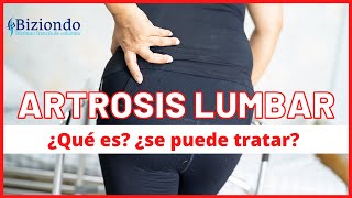 ▷ ARTROSIS LUMBAR  ︱ ¿Qué es? ¿Cómo tratar? ¿Se necesita operar? - Biziondo - Instituto Francés de Columna Vertebral