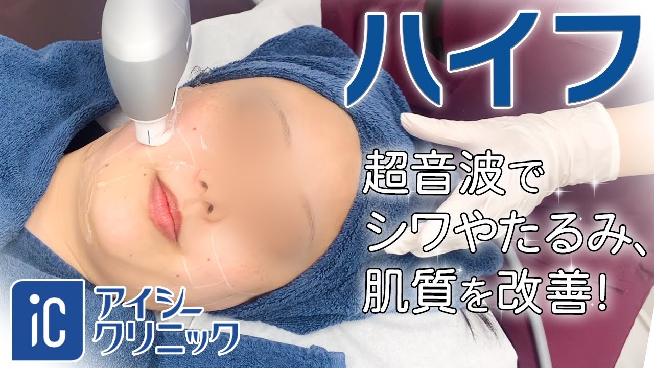 ハイフ全顔 施術動画 アイシークリニック