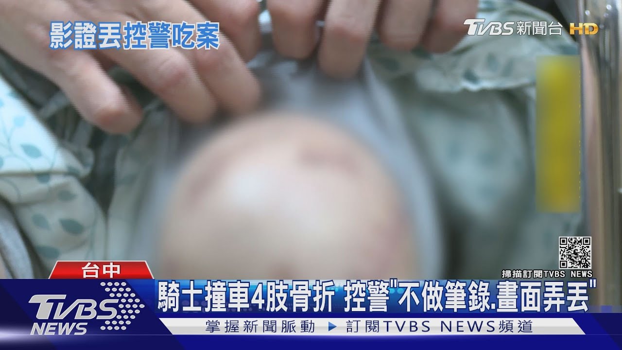 騎士撞車四肢骨折 控警「不做筆錄、畫面弄丟」