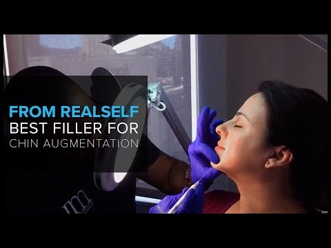 From RealSelf: "Best Filler for Chin Augmentation?"