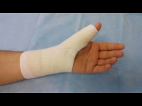 Si meret abdesi kur ke një gjymtyrë të vrarë dhe të fashuar? - Dr. Imam Ahmed Kalaja