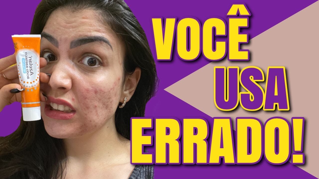 COMO USAR ÁCIDO PARA ESPINHAS CORRETAMENTE