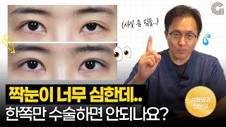 짝눈이 너무 심한데.. 한쪽만 수술이 가능할까?
