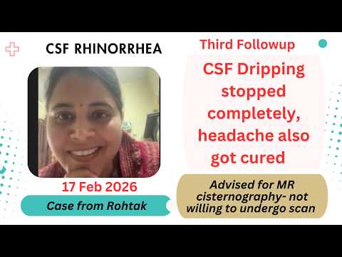 Amazing recovery in case of CSF Rhinorrhea