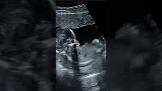 Omaya Zein TikTok - Pregnant 🤰 #shorts
