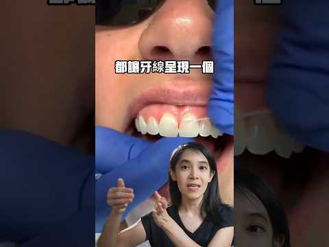 一件很重要但你一直做不對的事#牙科#牙齒
