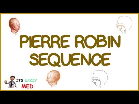 Pierre Robin Sequence (PRS)
