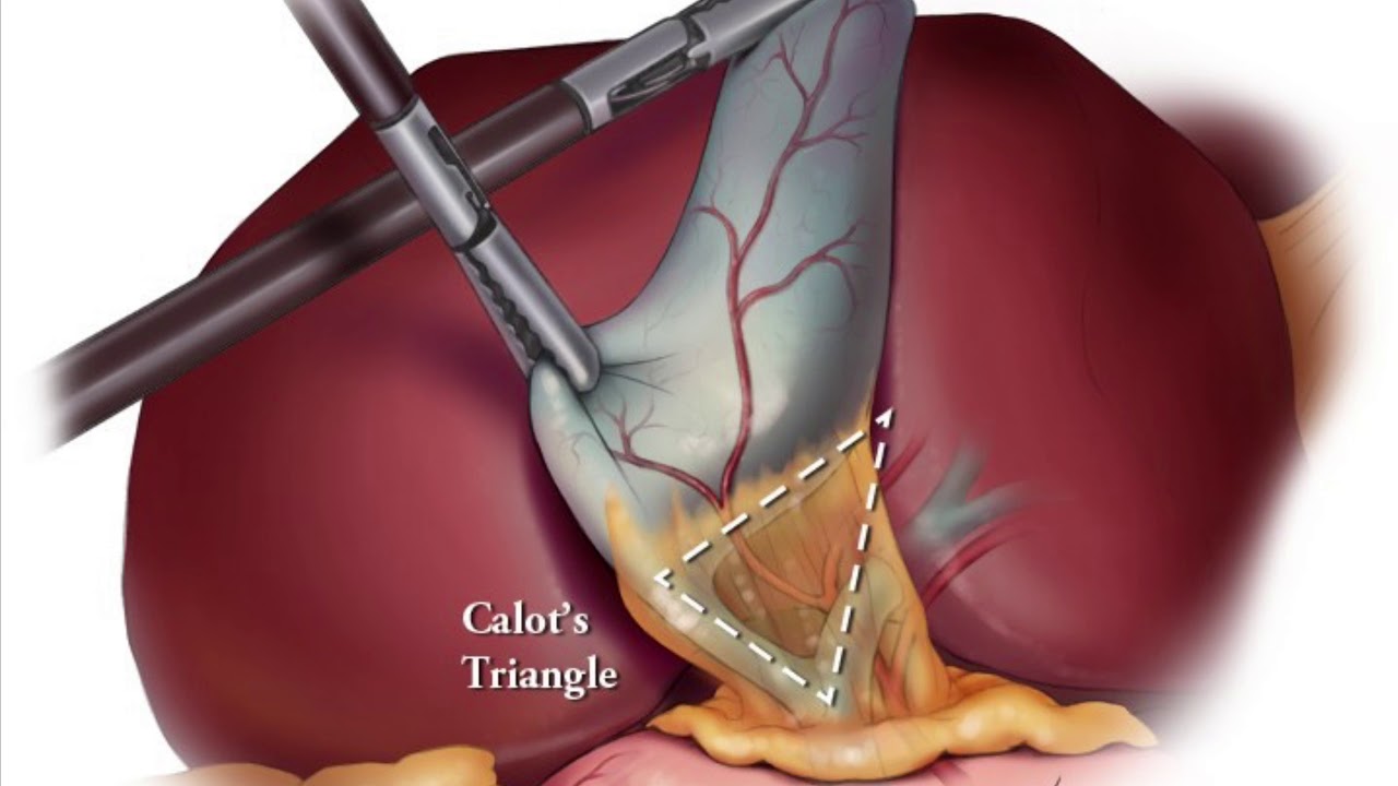 David Jonatan Ampudia Chávez-49