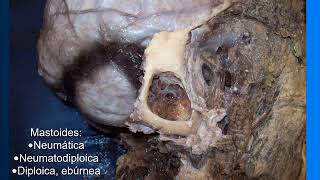 Teórico Oído (Parte 2)