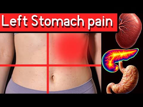 Top 7 Causes of Left Upper Abdominal Pain: (Left Upper Quadrant Pain)