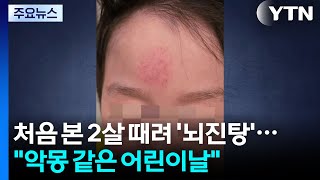 처음 본 2살 때려 '뇌진탕'..."악몽 같은 어린이날" / YTN