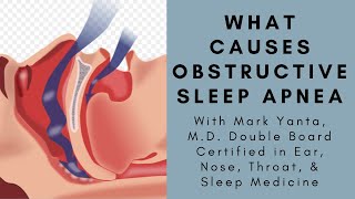 What causes Obstructive Sleep Apnea