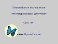 Differentiation Of Discrete Lesions Case 1411