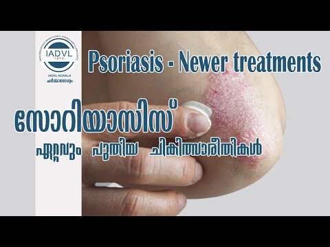 Psoriasis - Newer treatments