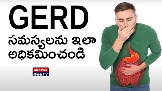 IBD Treatment – Modern Approaches