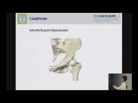 Platte aus Osteochondrose Gymnastik Hernie HWS Symptome und Behandlung