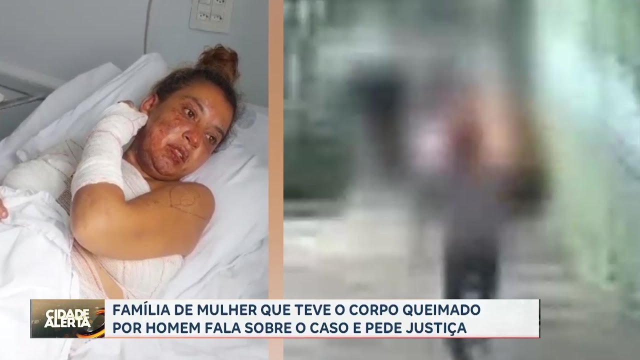 Família pede justiça após mulher ter 40% do corpo queimado pelo companheiro, em Franca