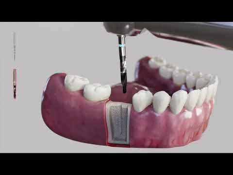 Video DESS – Caja Quirúrgica