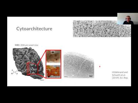 Sven Hildebrand: Investigating the human neocortex in 3D...