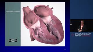 Inter-Atrial Shunt for Heart Failure with Preserved Ejection Fraction – Prof David Celermajer