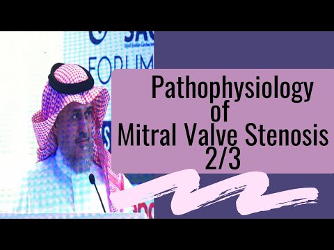 Pathophysiology of Mitral Valve Stenosis by Dr. Jameel Al-Ata 2/3