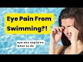 Eye Irritation In Pool | Swimmer's Eye | Chlorine Eyes Burning | How to get chlorine out of eyes