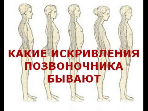 Хорошие упражнения для осанки Осанки испанки песня