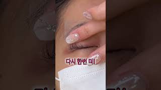 속눈썹 펌 성형 시술