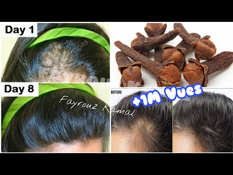 رشيها علي شعرك 7 أيام الكل هيسالك عن طول وكثافة وجمال شعرك / تطويل / تنعيم /ترطيب (بدون غسيل) هنا hana