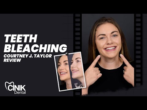 Courtney Jade Taylor | Teeth Bleaching Journey | CINIK Dental