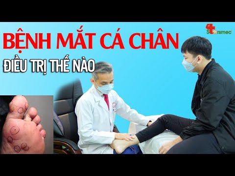 Bệnh mắt cá chân - Điều trị thế nào?