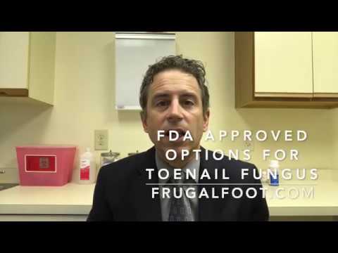 FDA Approved Options For Toenail Fungus