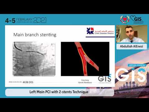02  Left Main PCI with 2 stents Technique   Abdullah AlEnezi