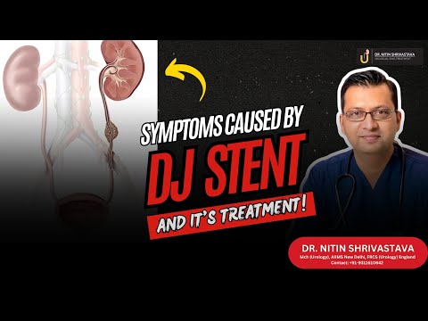 DJ Stent Symptoms and Treatment - What to Expect