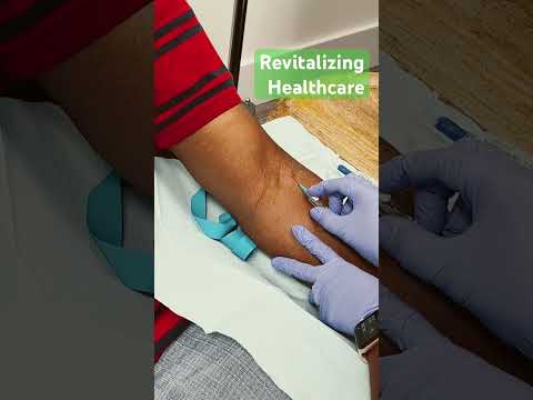 IV Catheter Insertion