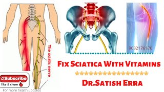 ఈ విటమిన్స్ వాడితే, Food తింటే Sciatica Nerve pain తగ్గుతుంది,వాడి చూడండి ✓Dr.Satish Erra's Homeo