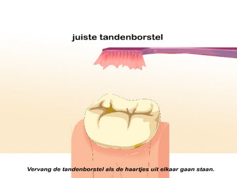 Tanden poetsen - Hoe kun je het beste je tanden poetsen?