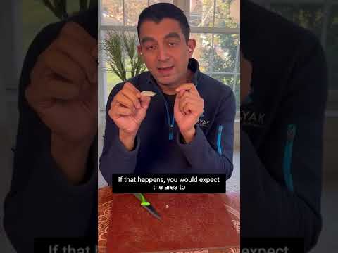 How Long Do Chin Implants Last?