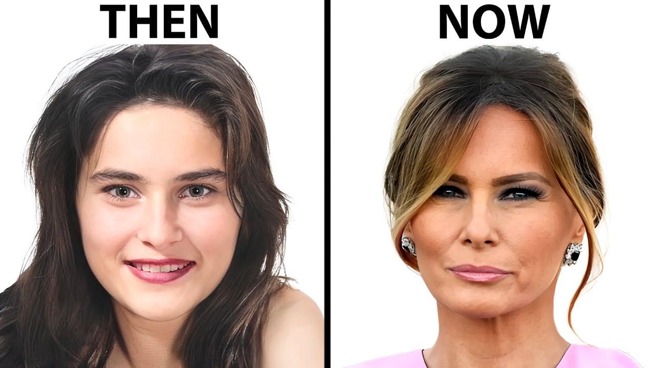 Melania Trump's NEW FACE | Plastic Surgery Analysis